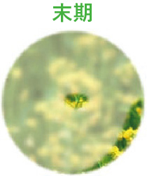 緑内障後期